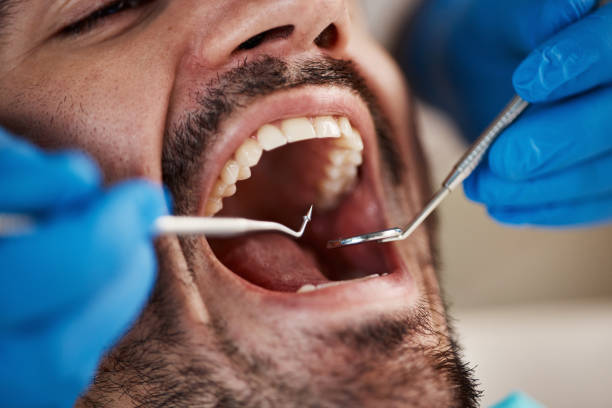 Best Broken Tooth Emergency  in Old Forge, PA